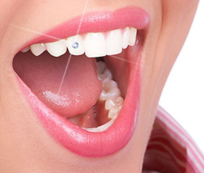 Tandsmycke swarowski